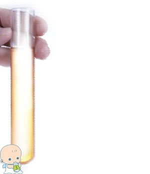 着床前診断 PGT